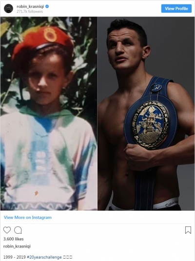 Robin Krasniqi "prish" trendin, publikon fotografinë e 20 viteve më parë
